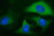Insulin Like Growth Factor 2 MRNA Binding Protein 2 antibody, GTX84309, GeneTex, Immunofluorescence image 