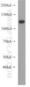 RNA Binding Motif Protein 19 antibody, 19095-1-AP, Proteintech Group, Western Blot image 