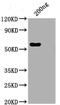 SARS CoV Nucleoprotein antibody, CSB-RA33255A1GMY, Cusabio, Western Blot image 