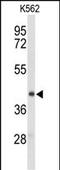 Ectonucleoside Triphosphate Diphosphohydrolase 2 antibody, A07914-1, Boster Biological Technology, Western Blot image 