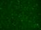 Calcium Voltage-Gated Channel Auxiliary Subunit Beta 4 antibody, SMC-318D-A488, StressMarq, Immunohistochemistry paraffin image 