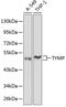 Thymidine Phosphorylase antibody, GTX33396, GeneTex, Western Blot image 