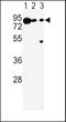 Dopachrome Tautomerase antibody, GTX81039, GeneTex, Western Blot image 