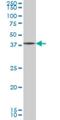 Growth Differentiation Factor 7 antibody, H00151449-M04, Novus Biologicals, Western Blot image 