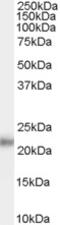 O-Linked N-Acetylglucosamine (GlcNAc) Transferase antibody, 45-995, ProSci, Immunofluorescence image 