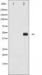 Jun Proto-Oncogene, AP-1 Transcription Factor Subunit antibody, TA325597, Origene, Western Blot image 