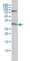 Serine/Threonine Kinase 16 antibody, orb89737, Biorbyt, Western Blot image 