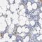 Transgelin 2 antibody, NBP1-89722, Novus Biologicals, Immunohistochemistry frozen image 