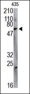 Coilin antibody, 200178, Abbiotec, Western Blot image 