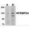 FERM And PDZ Domain Containing 4 antibody, MBS150540, MyBioSource, Western Blot image 