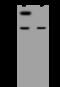 Secretin Receptor antibody, 200266-T32, Sino Biological, Western Blot image 