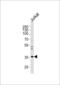 Glycine Receptor Beta antibody, LS-C166513, Lifespan Biosciences, Western Blot image 