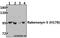 Rabenosyn, RAB Effector antibody, A09291-1, Boster Biological Technology, Western Blot image 