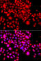 Activating signal cointegrator 1 complex subunit 3 antibody, STJ110267, St John