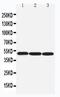 Arrestin Beta 1 antibody, PA5-78823, Invitrogen Antibodies, Western Blot image 