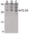 TNF Superfamily Member 15 antibody, PA5-20210, Invitrogen Antibodies, Western Blot image 