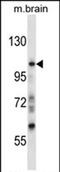 PEAK1 Related, Kinase-Activating Pseudokinase 1 antibody, PA5-71902, Invitrogen Antibodies, Western Blot image 
