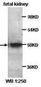 Kruppel Like Factor 8 antibody, abx037525, Abbexa, Enzyme Linked Immunosorbent Assay image 