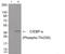CCAAT Enhancer Binding Protein Alpha antibody, 79-898, ProSci, Western Blot image 