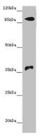 DNA Methyltransferase 3 Beta antibody, LS-C682175, Lifespan Biosciences, Western Blot image 