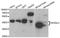 SH3 Domain Containing GRB2 Like 2, Endophilin A1 antibody, A5701, ABclonal Technology, Western Blot image 