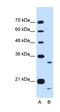 Cell Cycle Progression 1 antibody, orb325279, Biorbyt, Western Blot image 