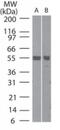 TNF Receptor Associated Factor 6 antibody, GTX13853, GeneTex, Western Blot image 