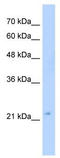 Guanosine Monophosphate Reductase 2 antibody, TA346626, Origene, Western Blot image 