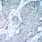 Kinase Insert Domain Receptor antibody, 79-314, ProSci, Immunohistochemistry frozen image 