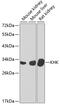 Ketohexokinase antibody, GTX33283, GeneTex, Western Blot image 