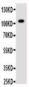 Receptor Tyrosine Kinase Like Orphan Receptor 1 antibody, PA1862, Boster Biological Technology, Western Blot image 