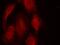 Cyclin Dependent Kinase 6 antibody, GTX50664, GeneTex, Immunofluorescence image 