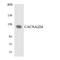 Calcium Voltage-Gated Channel Auxiliary Subunit Alpha2delta 4 antibody, LS-C200193, Lifespan Biosciences, Western Blot image 