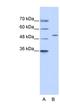 Zinc Finger Protein 555 antibody, NBP1-80167, Novus Biologicals, Western Blot image 