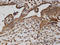 Adaptor Related Protein Complex 2 Subunit Beta 1 antibody, LS-C133857, Lifespan Biosciences, Immunohistochemistry paraffin image 