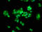 THO Complex 5 antibody, LS-C672406, Lifespan Biosciences, Immunofluorescence image 