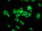 THO complex subunit 5 homolog antibody, LS-C672406, Lifespan Biosciences, Immunofluorescence image 