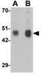 Rab Interacting Lysosomal Protein Like 1 antibody, GTX32031, GeneTex, Western Blot image 