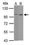 Rho GTPase Activating Protein 26 antibody, GTX107991, GeneTex, Western Blot image 