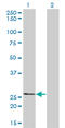 Thiamine Triphosphatase antibody, LS-C105174, Lifespan Biosciences, Western Blot image 