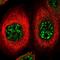 Forkhead Box O4 antibody, NBP2-58083, Novus Biologicals, Immunocytochemistry image 