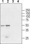 Glycine Receptor Beta antibody, PA5-77443, Invitrogen Antibodies, Western Blot image 