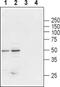 Glycine Receptor Beta antibody, PA5-77443, Invitrogen Antibodies, Western Blot image 