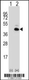 Bft antibody, 62-833, ProSci, Western Blot image 