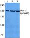 Insulin Receptor Substrate 1 antibody, PA5-36828, Invitrogen Antibodies, Western Blot image 