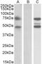 Galectin 3 antibody, 42-452, ProSci, Western Blot image 