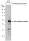 Caspase 4 antibody, GTX113639, GeneTex, Western Blot image 