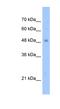 Tigger Transposable Element Derived 3 antibody, NBP1-70724, Novus Biologicals, Western Blot image 