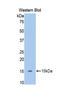 Slit Guidance Ligand 2 antibody, LS-C303990, Lifespan Biosciences, Western Blot image 