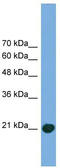 COMM Domain Containing 8 antibody, TA344959, Origene, Western Blot image 